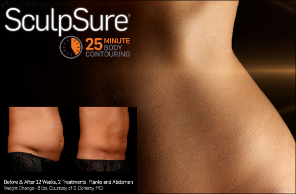 Incorporate SculpSure, the Non-Surgical Fat Treatment, Into Your Busy Schedule Incorporate SculpSure, the Non-Surgical Fat Treatment, Into Your Busy Schedule