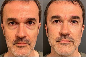 Dr. Antoni Calmon Treatments